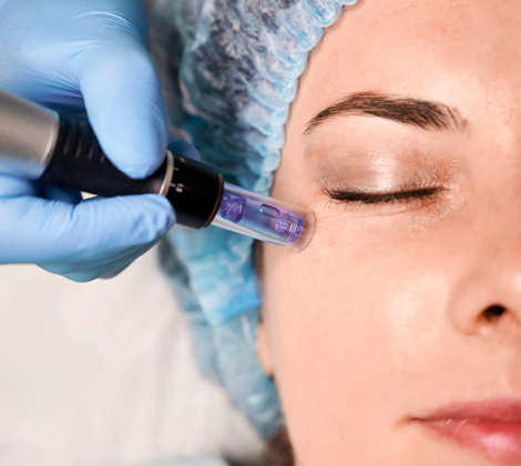 Hydrafacial