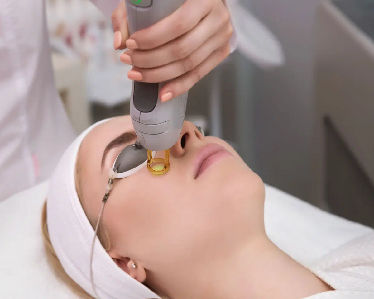 Laser Treatments
